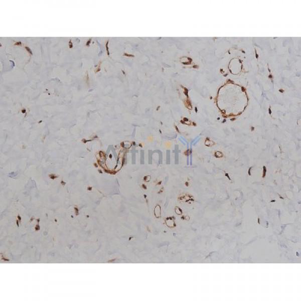 Phospho-Tau (Ser396) Antibody - AF3148 at 1/200 staining Human esophagus tissue sections by IHC-P.