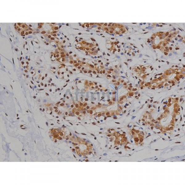 Phospho-Tau (Ser396) Antibody - AF3148 at 1/200 staining Human heart tissue sections by IHC-P.