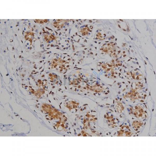 Phospho-Tau (Ser396) Antibody - AF3148 at 1/200 staining Human heart tissue sections by IHC-P.