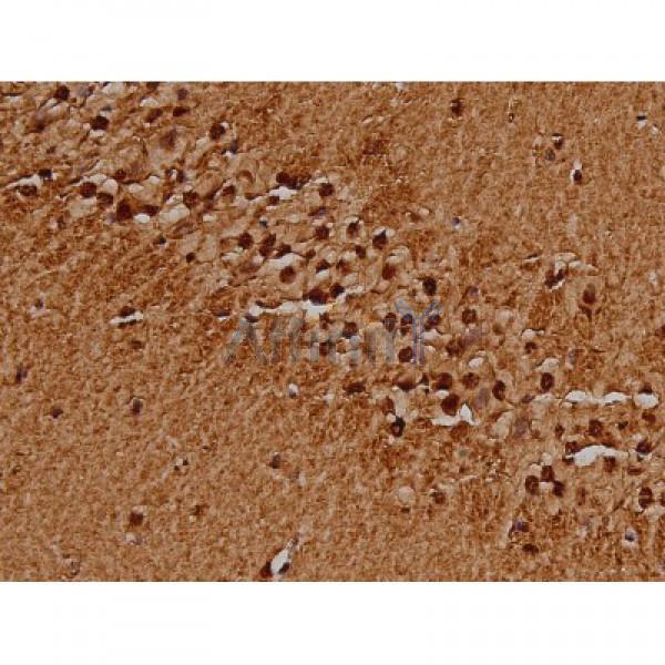 Phospho-Tau (Ser396) Antibody - AF3148 at 1/200 staining Mouse brain tissue sections by IHC-P.