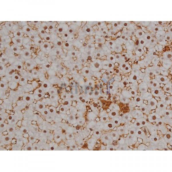 Phospho-Tau (Ser396) Antibody - AF3148 at 1/200 staining Rat liver tissue sections by IHC-P.
