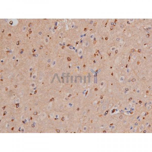 Phospho-Tau (Thr181)[Thr498] Antibody - AF3149 at 1/200 staining Mouse brain tissue sections by IHC-P.