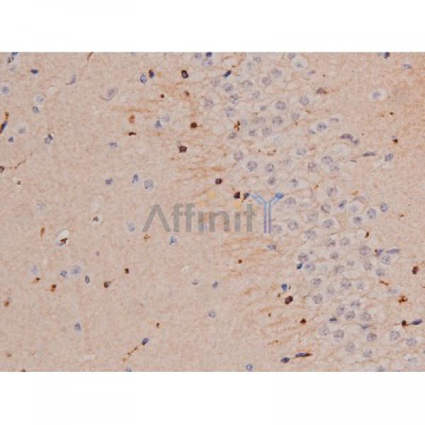 Phospho-Tau (Thr181)[Thr498] Antibody - AF3149 at 1/200 staining Mouse brain tissue sections by IHC-P.