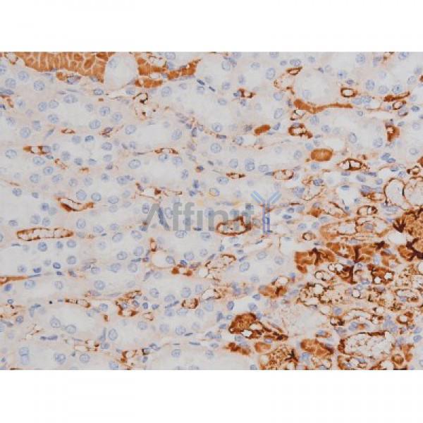 Phospho-Tau (Thr181)[Thr498] Antibody - AF3149 at 1/200 staining Rat kidney tissue sections by IHC-P.