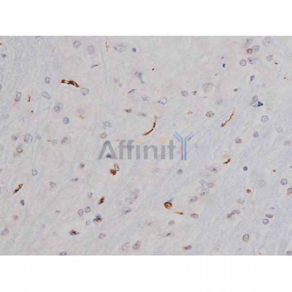 Phospho-Tau (Thr205)[Thr522] Antibody - AF3150 at 1/200 staining Rat brain tissue sections by IHC-P.