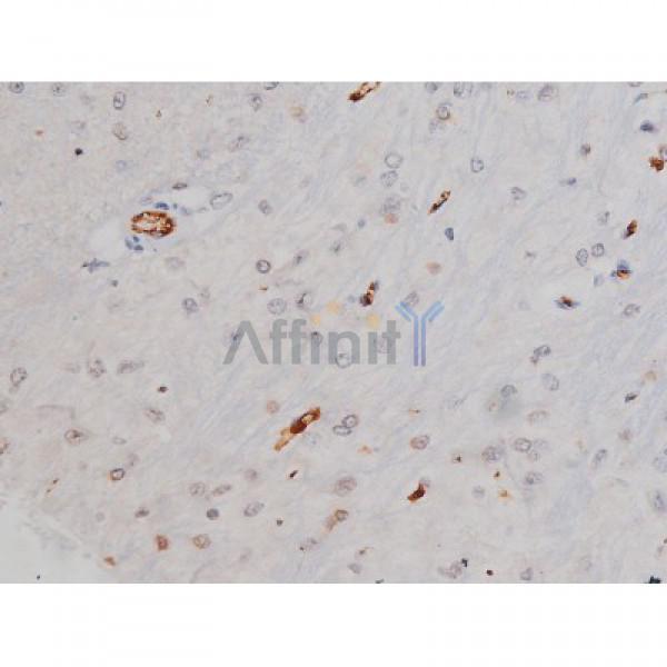 Phospho-Tau (Thr205)[Thr522] Antibody - AF3150 at 1/200 staining Rat brain tissue sections by IHC-P.