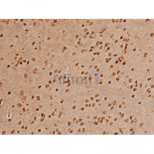 Phospho-Ezrin (Tyr353)[Tyr354] Antibody - AF3173 at 1/200 staining Mouse brain tissue sections by IHC-P.