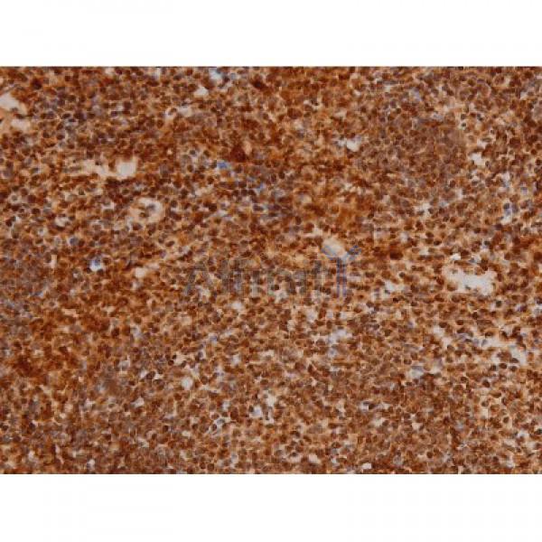 Phospho-Ezrin (Tyr353)[Tyr354] Antibody - AF3173 at 1/200 staining Mouse spleen tissue sections by IHC-P.