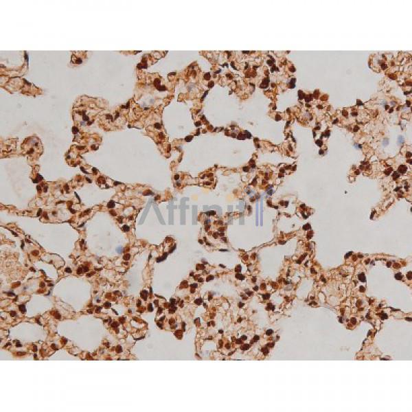 Phospho-Ezrin (Tyr353)[Tyr354] Antibody - AF3173 at 1/200 staining Rat lung tissue sections by IHC-P.