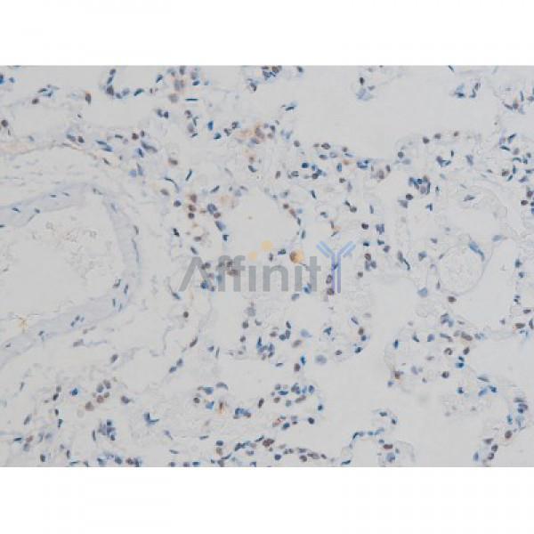 Phospho-Histone H2A.X (Ser139)[Ser140] Antibody - AF3187 at 1/200 staining Rat lung tissue sections by IHC-P.