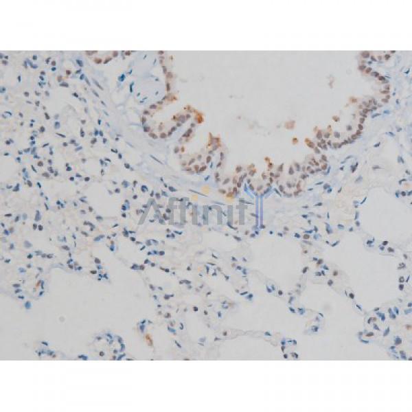 Phospho-Histone H2A.X (Ser139)[Ser140] Antibody - AF3187 at 1/200 staining Rat lung tissue sections by IHC-P.