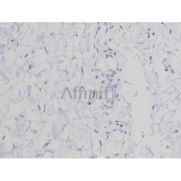 Phospho-AKT1 (Thr450) Antibody - AF3259 at 1/200 staining Human esophagus tissue sections by IHC-P.