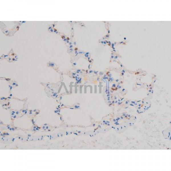 Phospho-AKT1 (Thr450) Antibody - AF3259 at 1/200 staining Rat lung tissue sections by IHC-P.