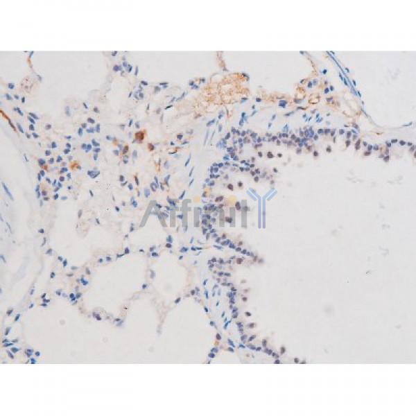 Phospho-STAT1 (Ser727) Antibody - AF3299 at 1/200 staining Rat lung tissue sections by IHC-P.