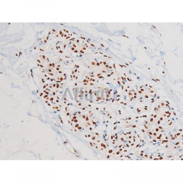 Phospho-JNK1/2/3 (Thr183+Tyr185) Antibody - AF3318 at 1/200 staining Human heart tissue sections by IHC-P.