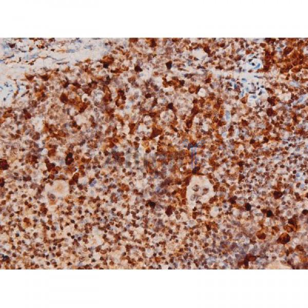 Phospho-JNK1/2/3 (Thr183+Tyr185) Antibody - AF3318 at 1/200 staining Mouse spleen tissue sections by IHC-P.