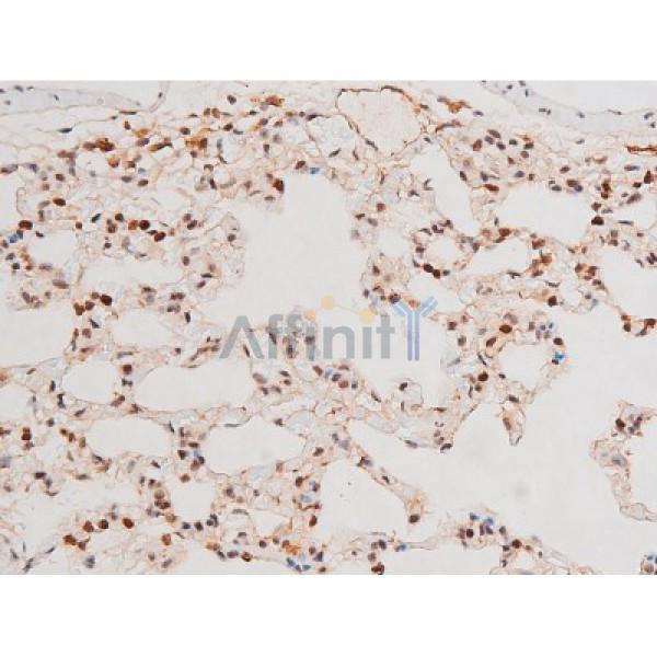 Phospho-JNK1/2/3 (Thr183+Tyr185) Antibody - AF3318 at 1/200 staining Rat lung tissue sections by IHC-P.