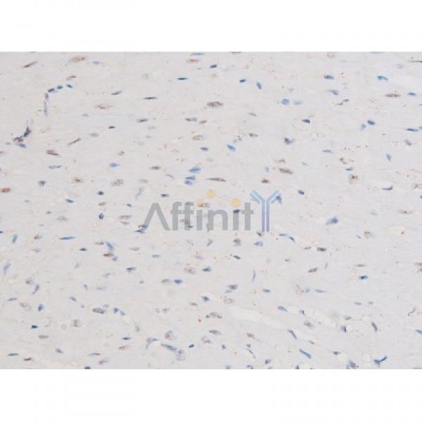 Phospho-NF-kB p65 (Ser281) Antibody - AF3393 at 1/200 staining Mouse heart tissue sections by IHC-P.