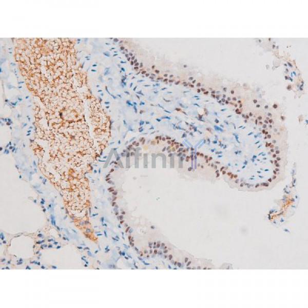 Phospho-NF-kB p65 (Ser281) Antibody - AF3393 at 1/200 staining Mouse lung tissue sections by IHC-P.