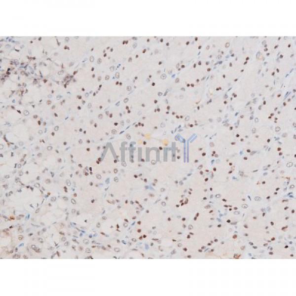 Phospho-NF-kB p65 (Ser281) Antibody - AF3393 at 1/200 staining Rat ganstric tissue sections by IHC-P.