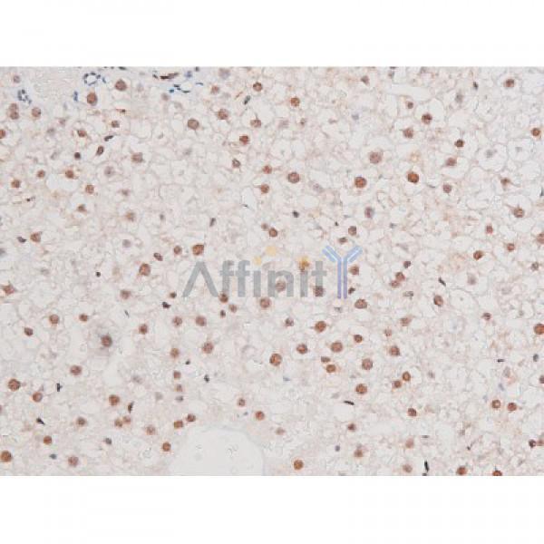 Phospho-NF-kB p65 (Ser281) Antibody - AF3393 at 1/200 staining Rat liver tissue sections by IHC-P.