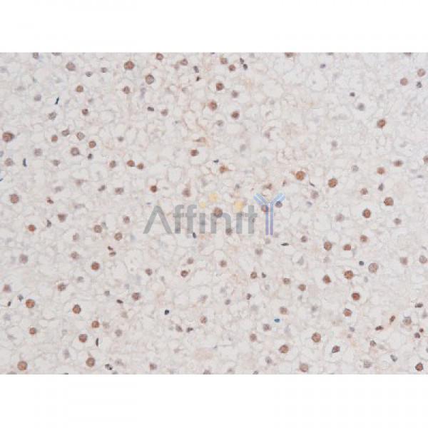 Phospho-NF-kB p65 (Ser281) Antibody - AF3393 at 1/200 staining Rat liver tissue sections by IHC-P.