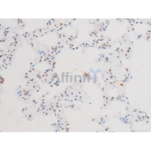 Phospho-NF-kB p65 (Ser281) Antibody - AF3393 at 1/200 staining Rat lung tissue sections by IHC-P.