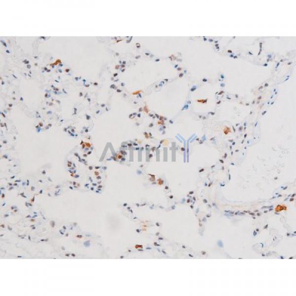 Phospho-NF-kB p65 (Ser281) Antibody - AF3393 at 1/200 staining Rat lung tissue sections by IHC-P.