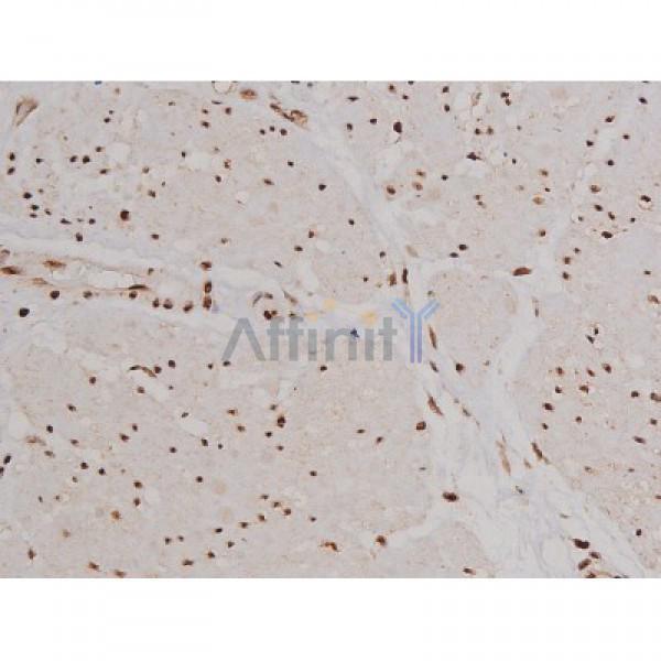 Phospho-FAK (Tyr397) Antibody - AF3398 at 1/200 staining Human esophagus tissue sections by IHC-P.