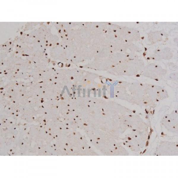Phospho-FAK (Tyr397) Antibody - AF3398 at 1/200 staining Human esophagus tissue sections by IHC-P.