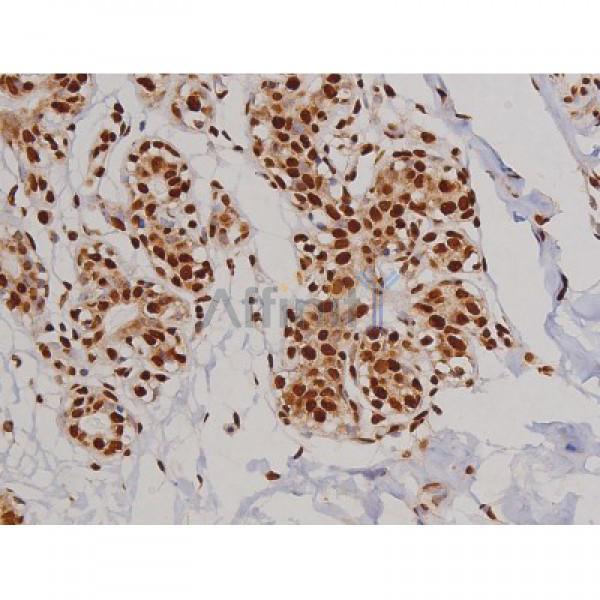 Phospho-FAK (Tyr397) Antibody - AF3398 at 1/200 staining Human heart tissue sections by IHC-P.