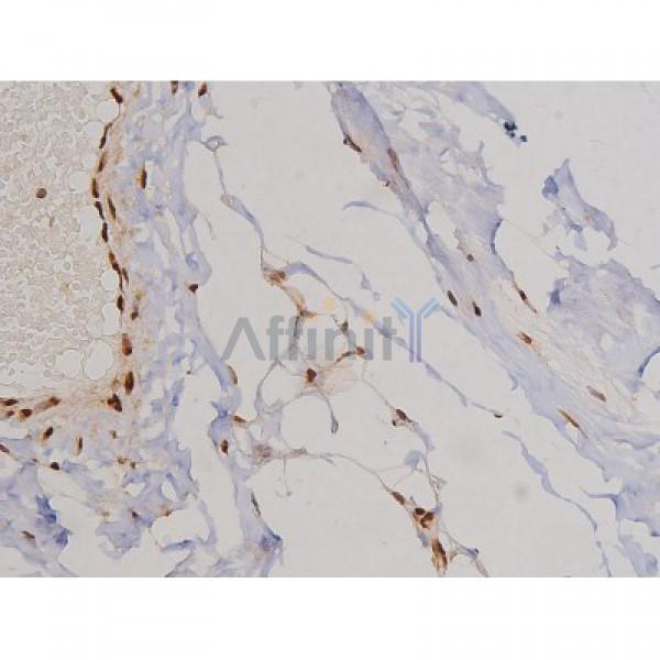 Phospho-FAK (Tyr397) Antibody - AF3398 at 1/200 staining Human heart tissue sections by IHC-P.