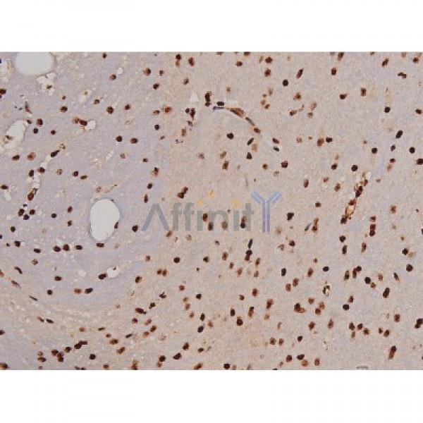 Phospho-FAK (Tyr397) Antibody - AF3398 at 1/200 staining Mouse brain tissue sections by IHC-P.