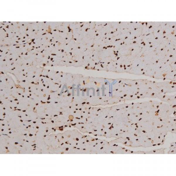 Phospho-FAK (Tyr397) Antibody - AF3398 at 1/200 staining Mouse heart tissue sections by IHC-P.