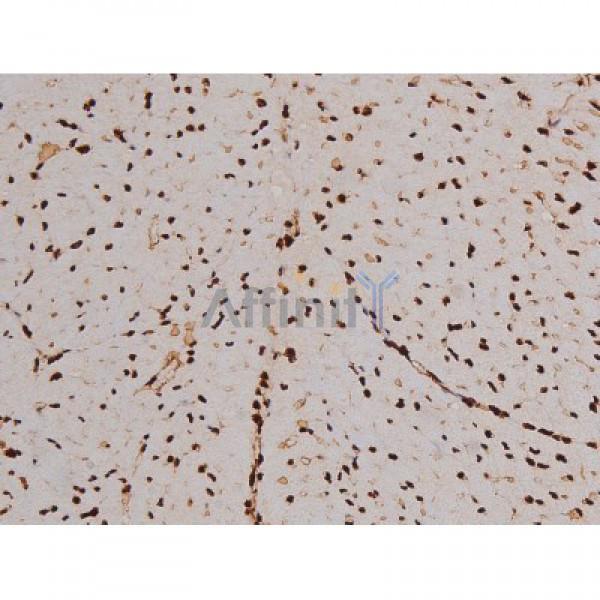 Phospho-FAK (Tyr397) Antibody - AF3398 at 1/200 staining Mouse heart tissue sections by IHC-P.