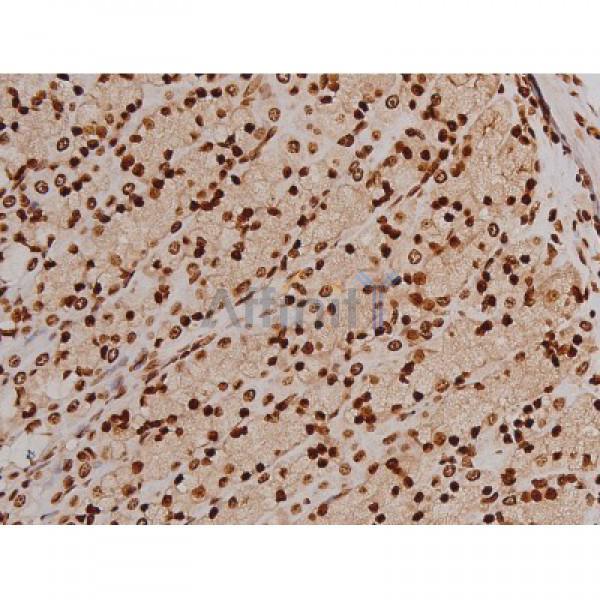 Phospho-FAK (Tyr397) Antibody - AF3398 at 1/200 staining Rat ganstric tissue sections by IHC-P.