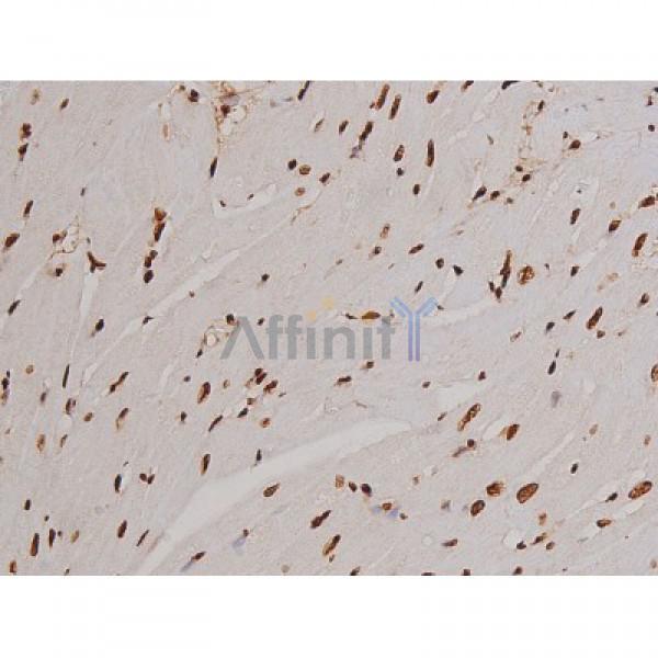 Phospho-FAK (Tyr397) Antibody - AF3398 at 1/200 staining Rat heart tissue sections by IHC-P.