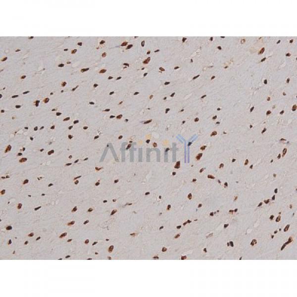 Phospho-FAK (Tyr397) Antibody - AF3398 at 1/200 staining Rat heart tissue sections by IHC-P.