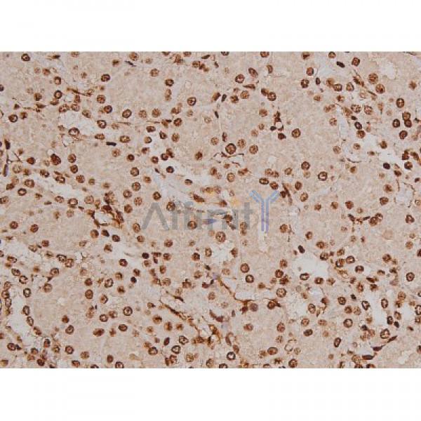 Phospho-FAK (Tyr397) Antibody - AF3398 at 1/200 staining Rat kidney tissue sections by IHC-P.