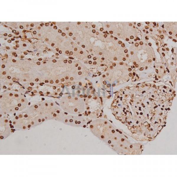 Phospho-FAK (Tyr397) Antibody - AF3398 at 1/200 staining Rat kidney tissue sections by IHC-P.