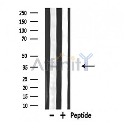 DGAT2L6 Antibody - Western blot analysis of extracts from Rat brain lysates, using DGAT2L6 antibody.