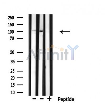 RNF111 Antibody - Western blot analysis of extracts from various samples, using RNF111 Antibody.