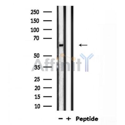 VGF Antibody - Western blot analysis of VGF  expression in Rat brain lysates .