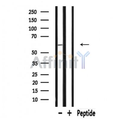 RAB11FIP2 Antibody - Western blot analysis of extracts from Rat brain lysates, using RAB11FIP2 antibody.