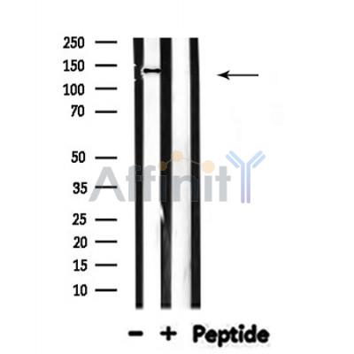 MOV10L1 Antibody - Western blot analysis of MOV10L1 expression in Rat brain lysates .