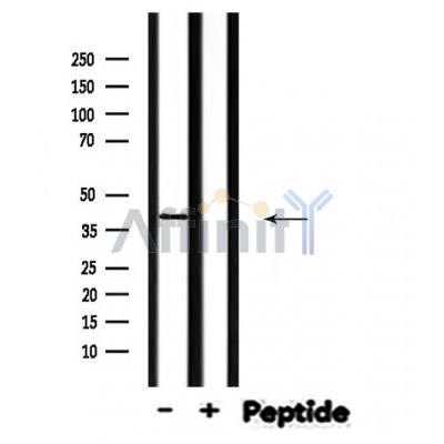 STK36 Antibody - Western blot analysis of STK36 expression in Mouse muscle lysates .