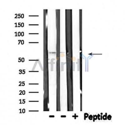 THBD Antibody - Western blot analysis of extracts from various samples, using THBD Antibody.