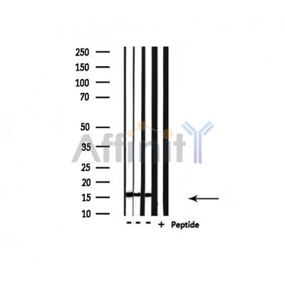 UBE2D2 Antibody - Western blot analysis of extracts from various samples, using UBE2D2 Antibody.