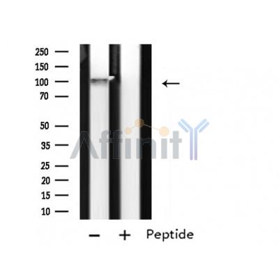 LRP8 Antibody - Western blot analysis of extracts from Rat spleen lysates, using LRP8 antibody.