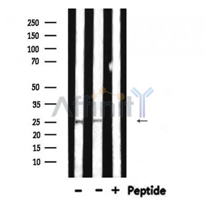 SNAP25 Antibody - Western blot analysis of extracts from various samples, using SNAP25 Antibody.